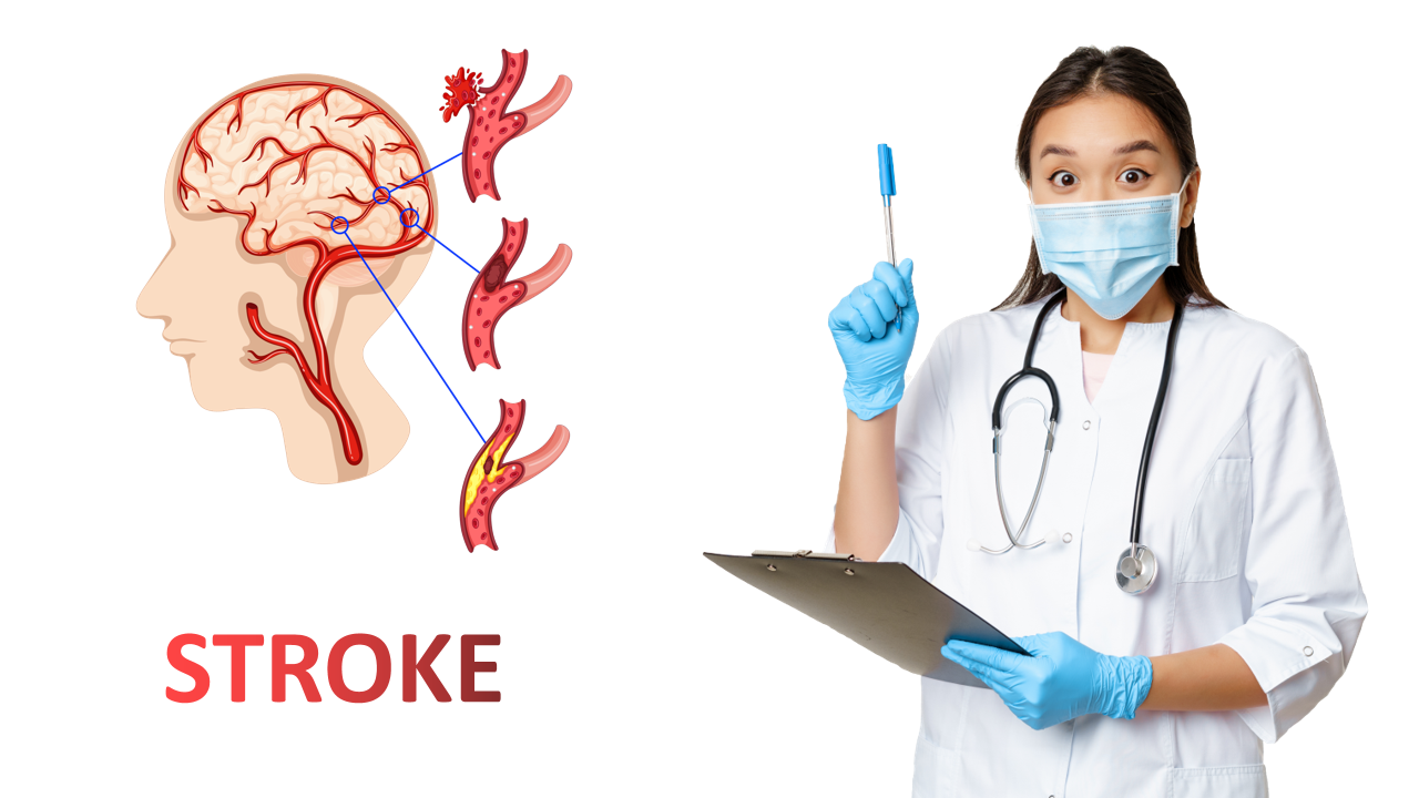 Penyebab Stroke: Memahami Risiko untuk Mencegahnya